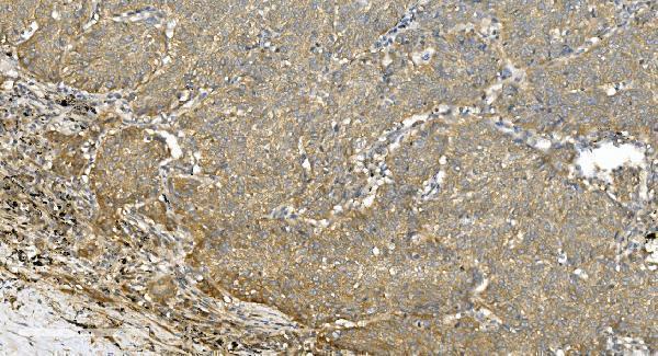 m03989 3 tubulin_alpha primary antibodies ihc testing 5