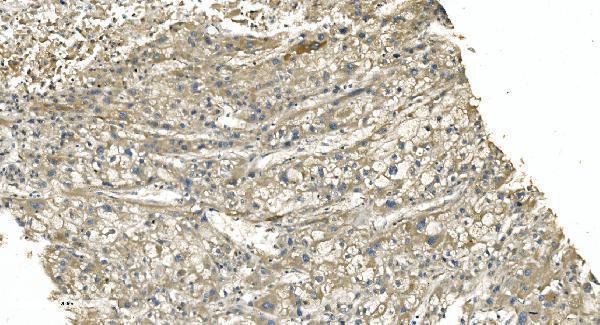 m03989 3 tubulin_alpha primary antibodies ihc testing 7