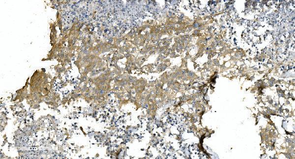 m03989 3 tubulin_alpha primary antibodies ihc testing 8