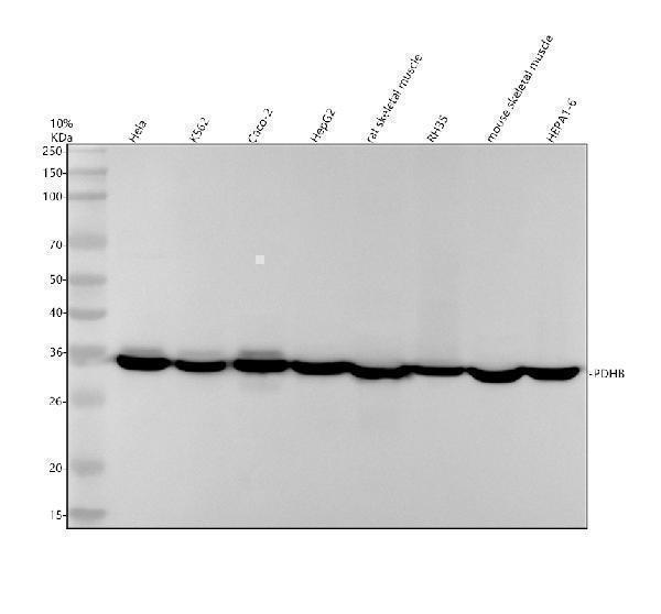 m03998 pdhb primary antibodies wb testing 1