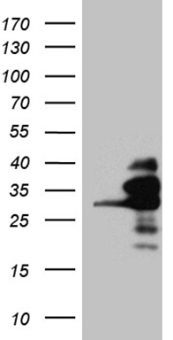 HEK293T cells were transfected with the pCMV6-ENTRY control (Left lane) or pCMV6-ENTRY RANBP1 (Right lane) cDNA for 48 hrs and lysed
