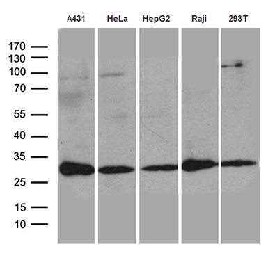 Western blot analysis of extracts (35ug) from 5 cell lines lysates by using anti-RANBP1 monoclonal antibody (1:500)