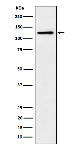 Western blot analysis of Palladin expression in PC3 cell lysate