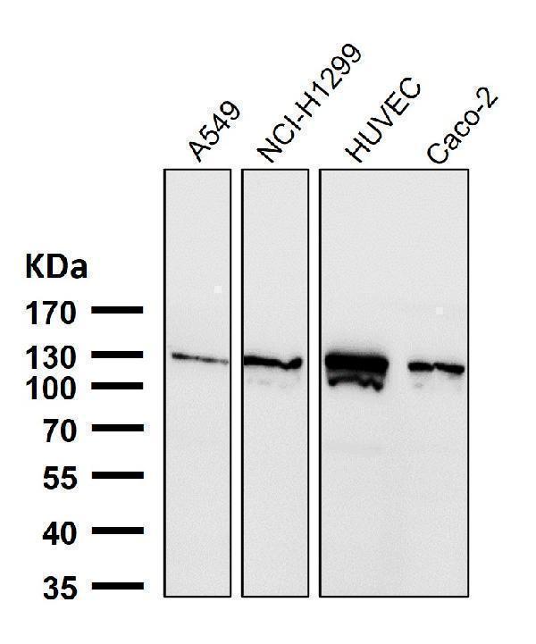 All lanes use the Antibody at 1:3K dilution for 1 hour at room temperature