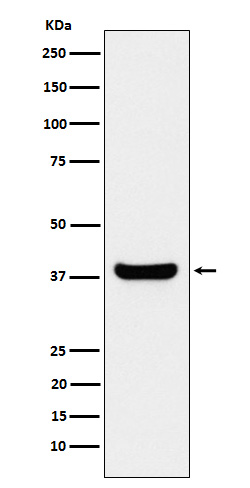 Western blot analysis of Protein Phosphatase 1 beta expression in Jurkat cell lysate.