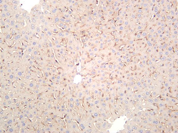 m04027 2 lyve1 primary antibodies ihc testing 1