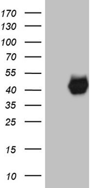 HEK293T cells were transfected with the pCMV6-ENTRY control (Left lane) or pCMV6-ENTRY PON3 (Right lane) cDNA for 48 hrs and lysed