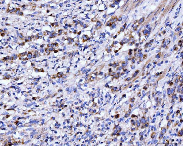  IHC analysis of DHODH using anti-DHODH antibody (M04035-1)