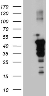 HEK293T cells were transfected with the pCMV6-ENTRY control (Left lane) or pCMV6-ENTRY NCK2 (Right lane) cDNA for 48 hrs and lysed
