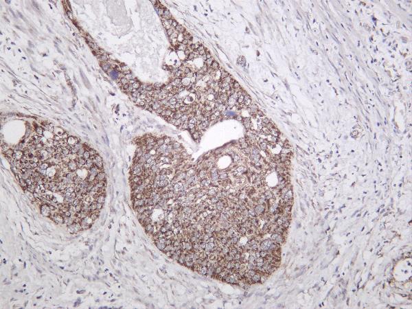 Human cervical carcinoma was stained with anti-TOMM20 rabbit antibody
