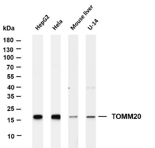 Various whole cell lysates were separated by 4-20% SDS-PAGE, and the membrane was blotted with anti-TOMM20 antibody