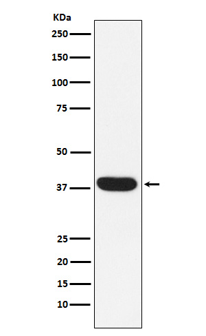 Western blot analysis of MYF5 expression in Human skeletal muscle lysate