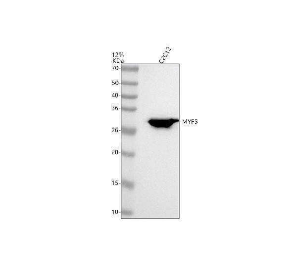 m04040 myf5 primary antibodies wb testing 1