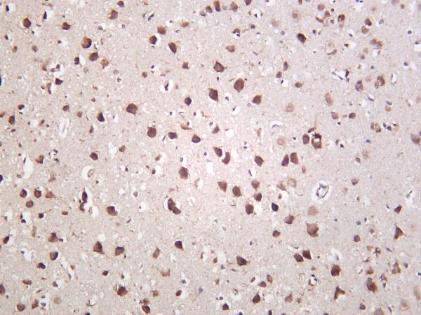 m04041 3 pvalb primary antibodies ihc testing 1