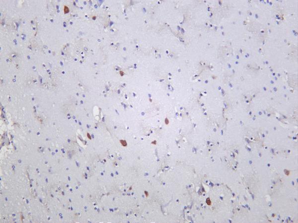 m04041 3 pvalb primary antibodies ihc testing 2