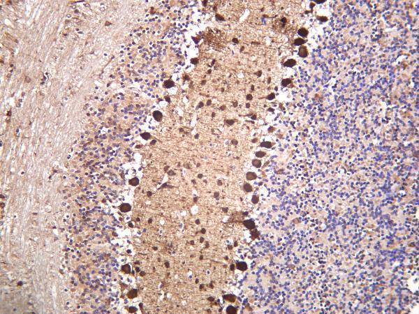 m04041 3 pvalb primary antibodies ihc testing 3