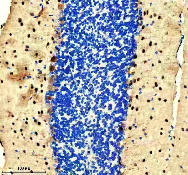 m04041 pvalb primary antibodies ihc testing 1_1