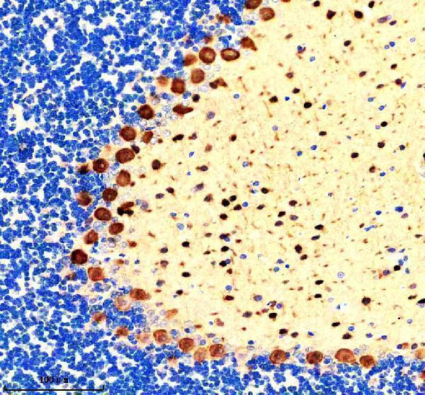 m04041 pvalb primary antibodies ihc testing 2_2