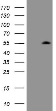 HEK293T cells were transfected with the pCMV6-ENTRY control (Left lane) or pCMV6-ENTRY ZIC3 (Right lane) cDNA for 48 hrs and lysed