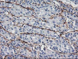 m04054 anti arh ldlrap1 mouse monoclonal antibody clone id oti7e11 ihc testing 3