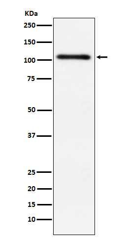 Western blot analysis of Protein Kinase D2 expression in HeLa cell lysate.