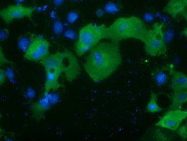 m04056 anti protein kinase d2 prkd2 mouse monoclonal antibody clone id oti5g1 if testing 8