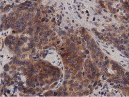 m04056 anti protein kinase d2 prkd2 mouse monoclonal antibody clone id oti5g1 ihc testing 3