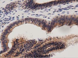 m04056 anti protein kinase d2 prkd2 mouse monoclonal antibody clone id oti5g1 ihc testing 4