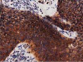 m04056 anti protein kinase d2 prkd2 mouse monoclonal antibody clone id oti5g1 ihc testing 5