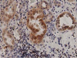 m04056 anti protein kinase d2 prkd2 mouse monoclonal antibody clone id oti5g1 ihc testing 6