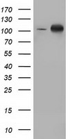 m04056 anti protein kinase d2 prkd2 mouse monoclonal antibody clone id oti5g1 wb testing 1