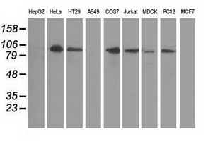 m04056 anti protein kinase d2 prkd2 mouse monoclonal antibody clone id oti5g1 wb testing 2