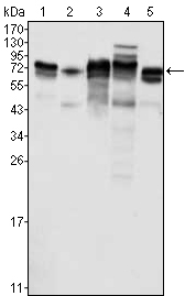 Western blotting validation for Anti-Protein LYRIC MTDH Monoclonal Antibody M04060-1
Western Blot (WB) analysis using MTDH Monoclonal Antibody against K562 (1)