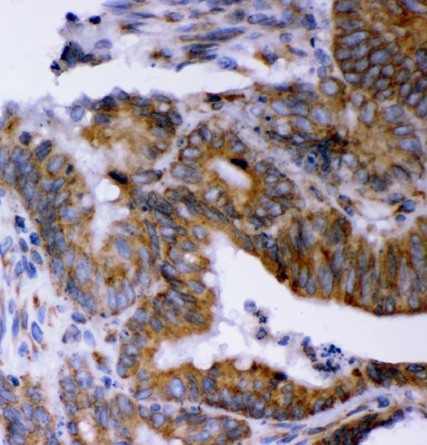  IHC analysis of LYRIC using anti-LYRIC antibody (M04060-2)