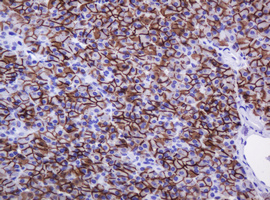 Immunohistochemical staining of paraffin-embedded Human pancreas tissue within the normal limits using anti-CA12 mouse monoclonal antibody