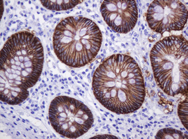 m04063 1 anti ca12 mouse monoclonal antibody clone id oti2c6 ihc testing 5