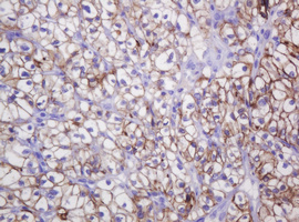 m04063 1 anti ca12 mouse monoclonal antibody clone id oti2c6 ihc testing 7