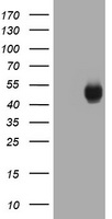 HEK293T cells were transfected with the pCMV6-ENTRY control (Left lane) or pCMV6-ENTRY CA12 (Right lane) cDNA for 48 hrs and lysed