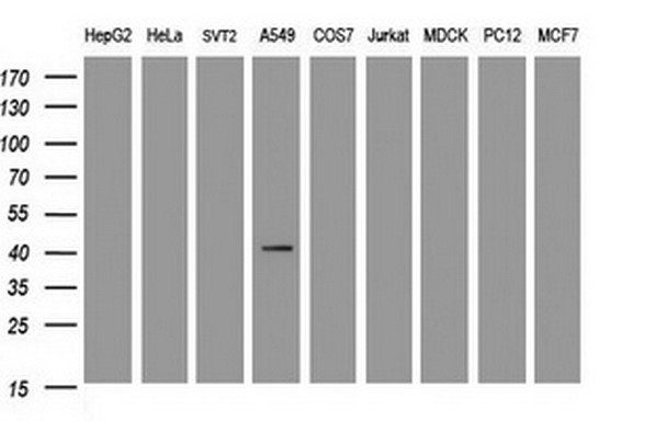 Western blot analysis of extracts (35ug) from 9 different cell lines by using anti-CA12 monoclonal antibody at 1:500 dilution