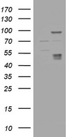 HEK293T cells were transfected with the pCMV6-ENTRY control (Left lane) or pCMV6-ENTRY CA12 (Right lane) cDNA for 48 hrs and lysed