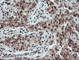 m04065 3 anti cd10 mme mouse monoclonal antibody clone id oti3d11 ihc testing 10