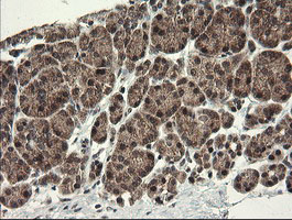 m04065 3 anti cd10 mme mouse monoclonal antibody clone id oti3d11 ihc testing 4