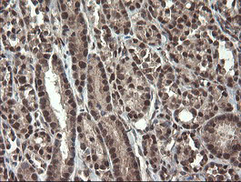 m04065 3 anti cd10 mme mouse monoclonal antibody clone id oti3d11 ihc testing 5
