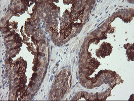 m04065 3 anti cd10 mme mouse monoclonal antibody clone id oti3d11 ihc testing 6