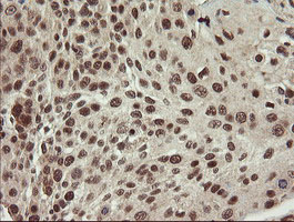 m04065 3 anti cd10 mme mouse monoclonal antibody clone id oti3d11 ihc testing 7