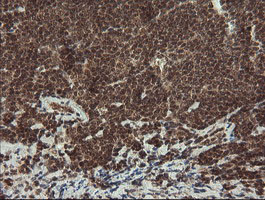 m04065 3 anti cd10 mme mouse monoclonal antibody clone id oti3d11 ihc testing 8
