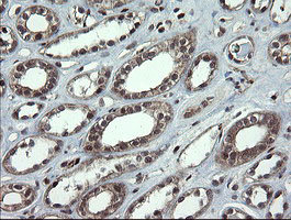 m04065 3 anti cd10 mme mouse monoclonal antibody clone id oti3d11 ihc testing 9