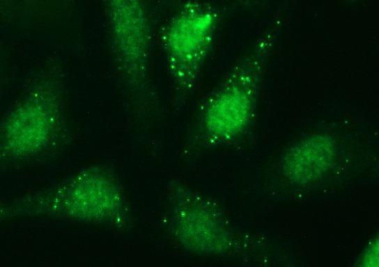 m04067 1 anti serpinb3 mouse monoclonal antibody clone id oti3g4 if testing 5