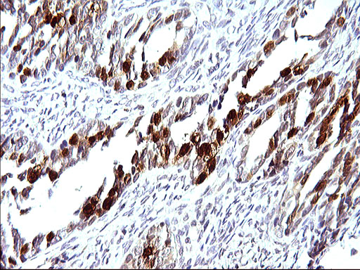 m04067 1 anti serpinb3 mouse monoclonal antibody clone id oti3g4 ihc testing 4