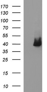 HEK293T cells were transfected with the pCMV6-ENTRY control (Left lane) or pCMV6-ENTRY SERPINB3 (Right lane) cDNA for 48 hrs and lysed